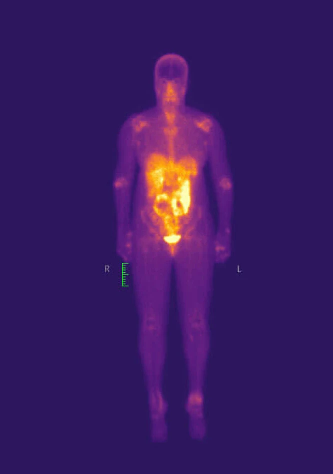 Full Body Scan