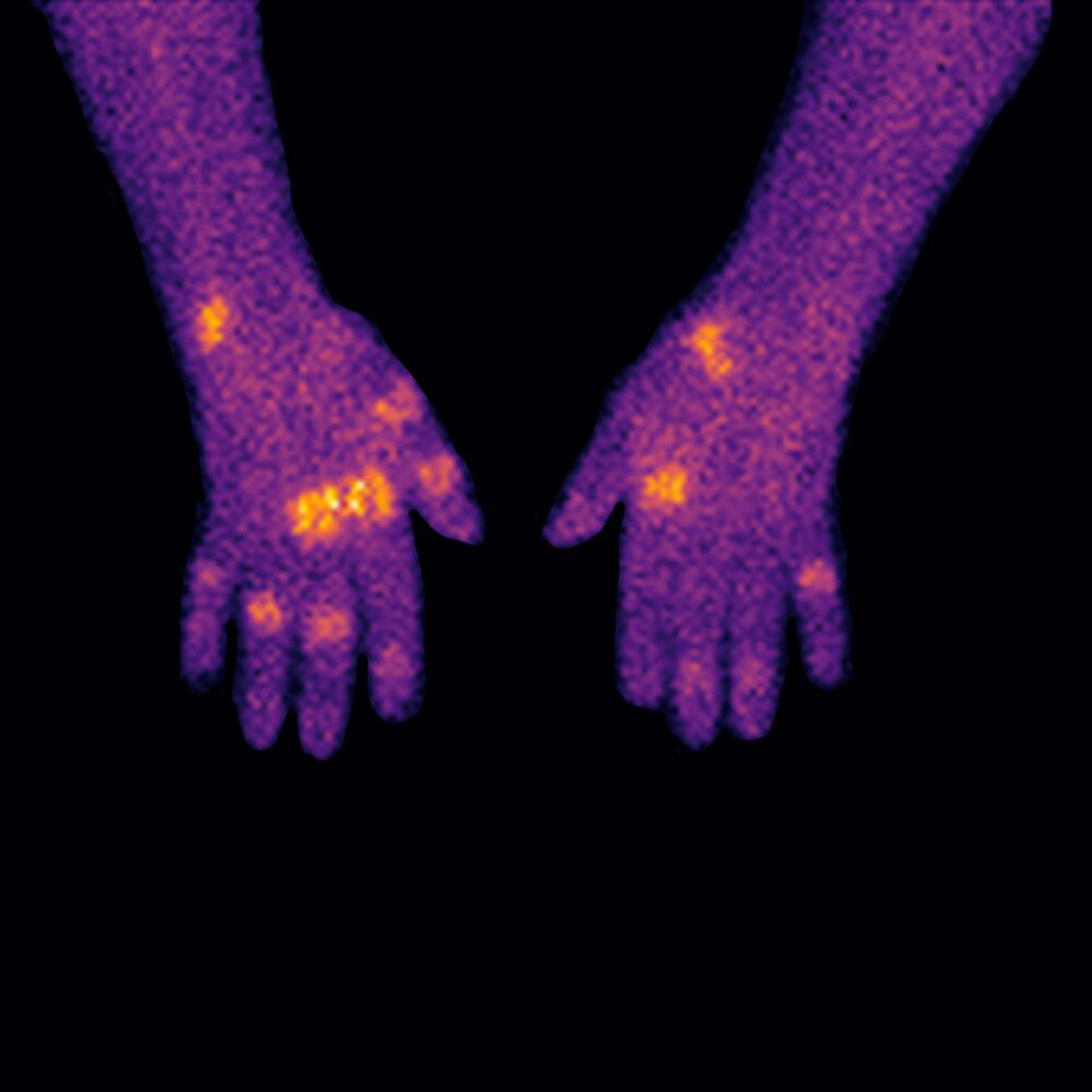 Hand Xtray Scan